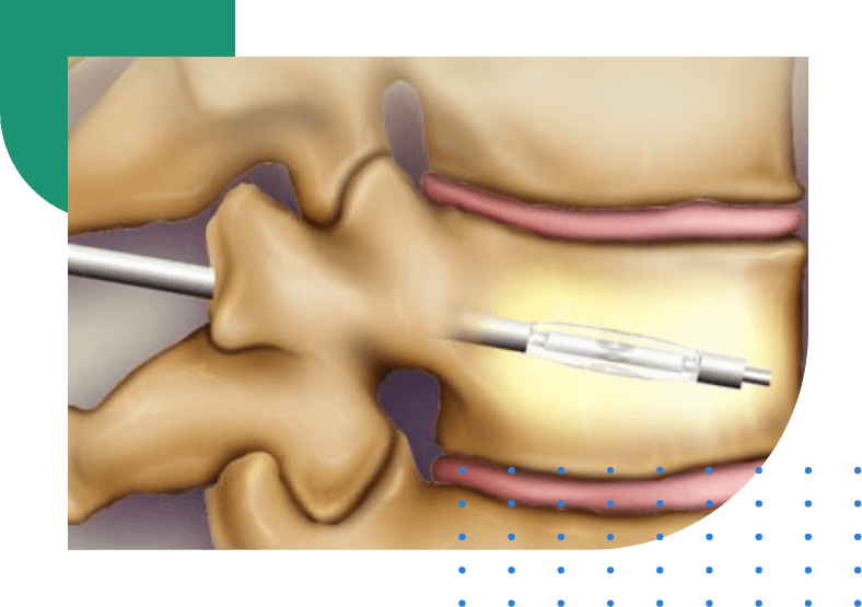 LSO MDM OrthopedicCollage 1