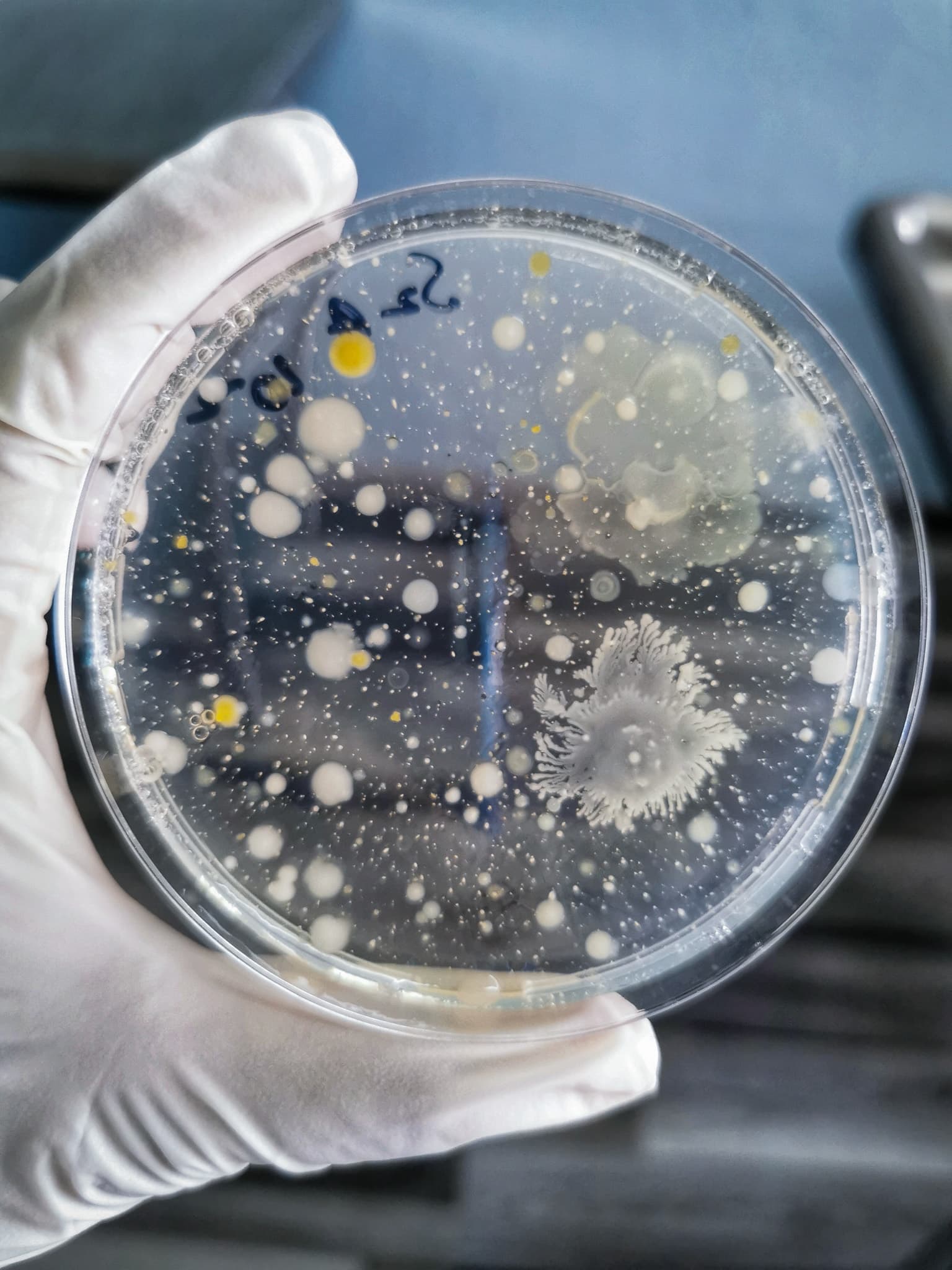 Microbial Growth on Agar Plate – Bioburden Testing