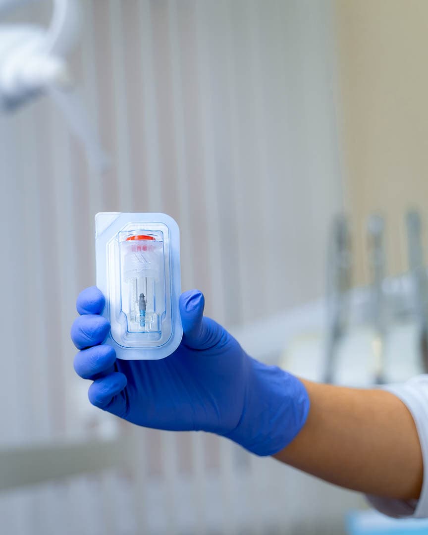 Dental,Implant,In,Dentist`s,Hands.,Modern,Dentistry,Concept.,Blurred,Background.